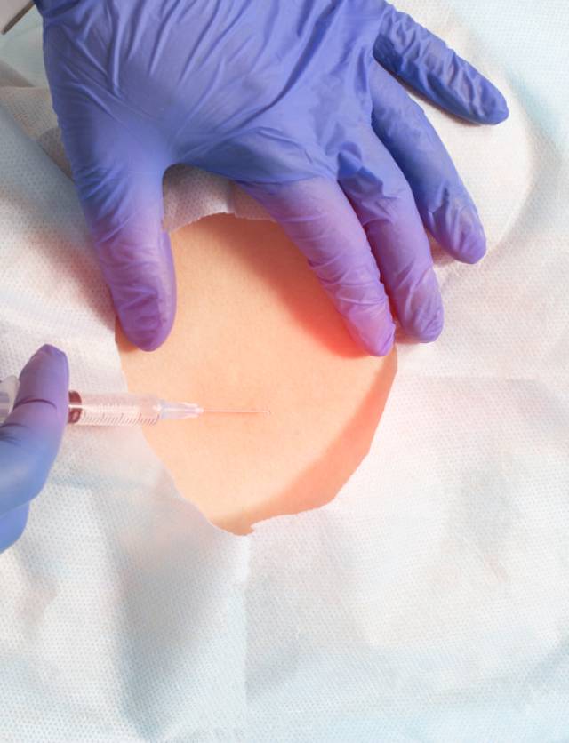 The,Doctor,Performs,An,Epidural,Block,On,A,Patient,For