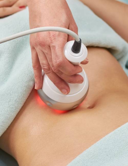 Radio,Frequency,Skin,Tightening,,Belly.,Female,Body,,Cosmetology,Procedure.